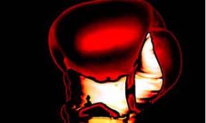 Father Time will always win in a KO.